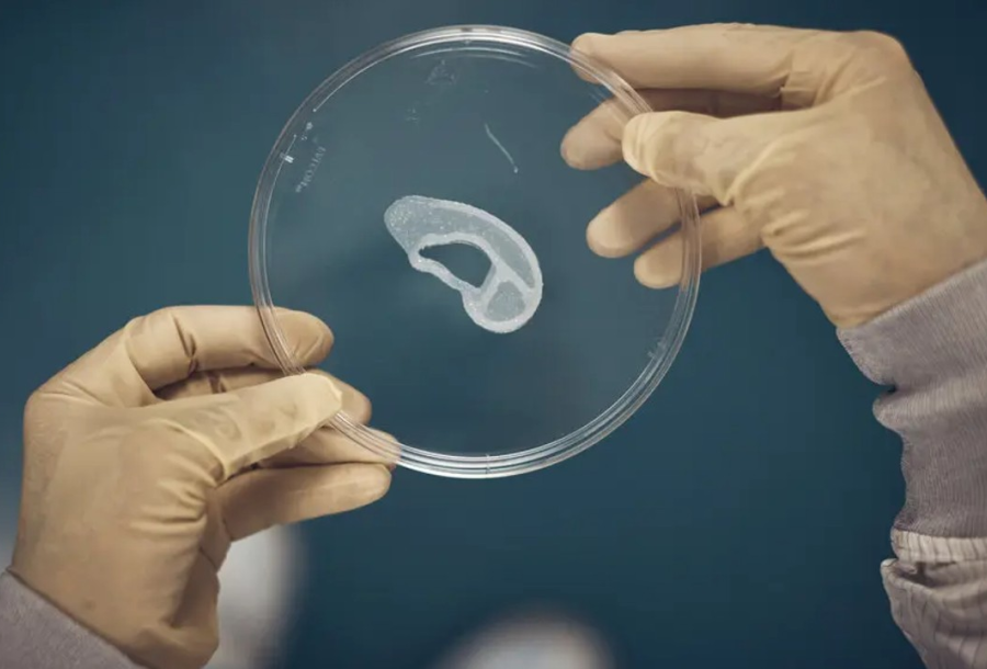 Tıp Dünyasında Yenilik: 3D Sayesinde Kulak Elde Edildi!